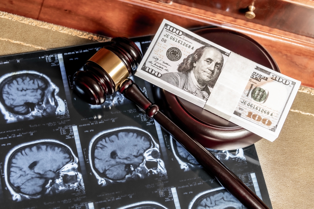 Hypoxic Brain Injury