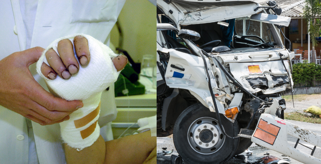 Types of Injuries from Truck Accidents